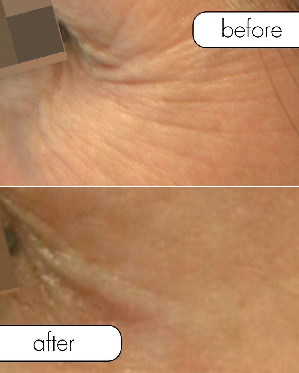 Mesoestetic® Mesoéclat® Pack