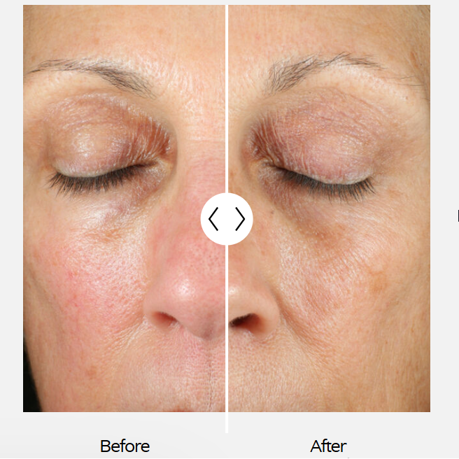 Renewal Crème